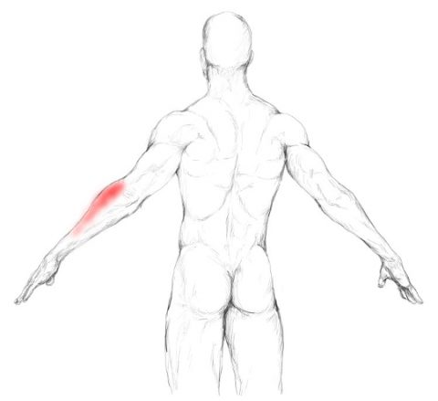 Muscle subclavier douleurs et trigger points