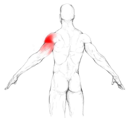 Muscle Petit Rond Muscle petit rond : douleurs et trigger points